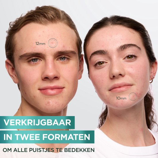 Twee jongeren tonen Garnier puistjespleisters in maten 12mm en 10mm.