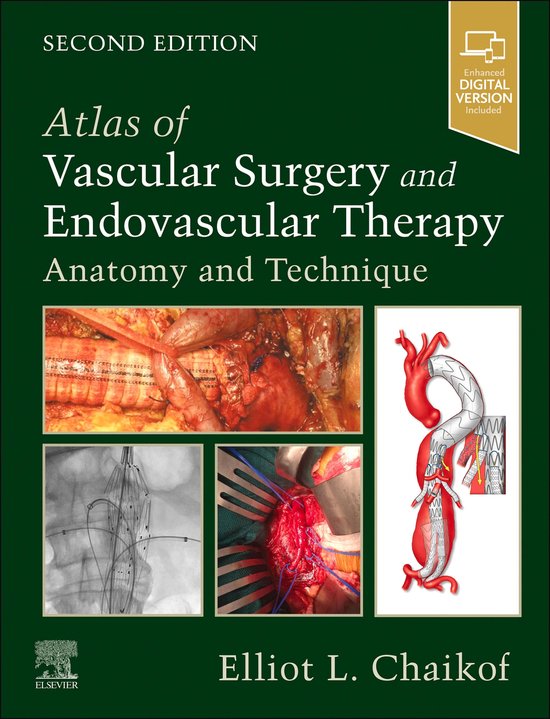 Atlas of Vascular Surgery and Endovascular Therapy E-Book - cover