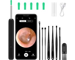 Oorsmeer verwijderingsset, 1080P HD WiFi Ohrenreiniger met camera en 6 LED's Leuchten, IPX5 Wasserdicht Ohrenspiegel, Ohr Reinigung voor Baby Kinder Erwachsene, Geschikt voor i-Phone Android (Zwart)