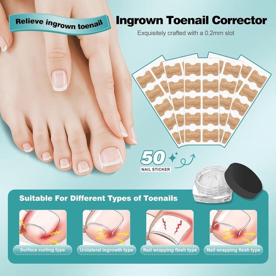 Set voor het corrigeren van ingegroeide teennagels met nagelsteun en pleisters voor grote tenen — afbeelding 5