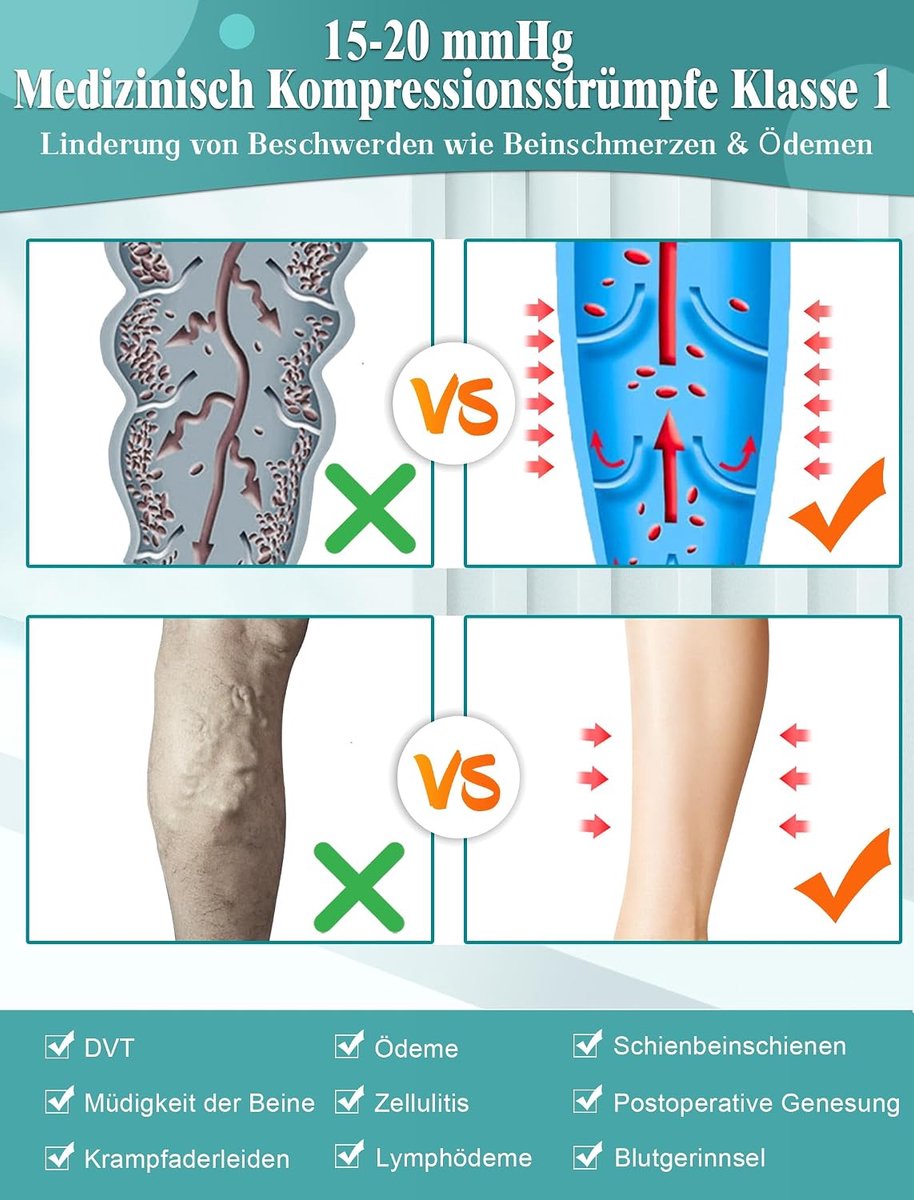 Kousen voor dames en heren, klasse 1, trombosekousen, 15-20 mmHg, lange trombosekousen, vlucht, compressiesokken, steunkousen voor spataderen, oedeem, DVT, XL