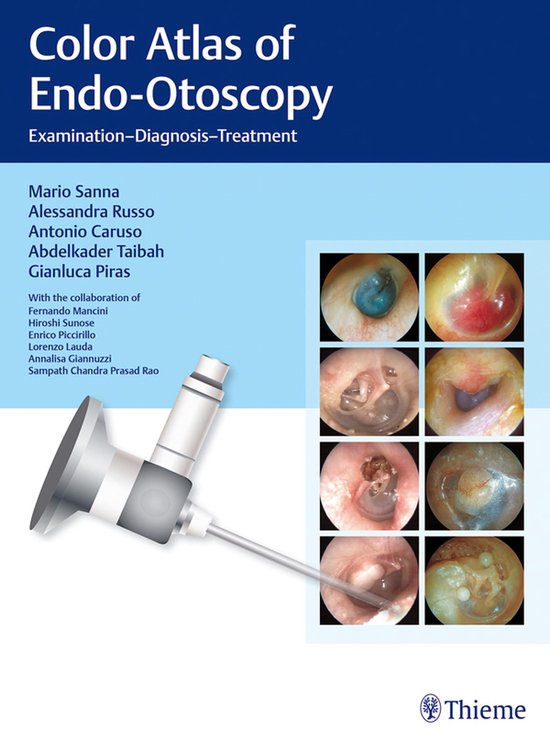 Color Atlas of Otoscopy - cover