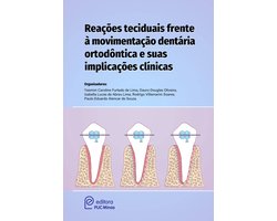 Reações teciduais frente à movimentação dentária ortodóntica e suas implicações clínicas