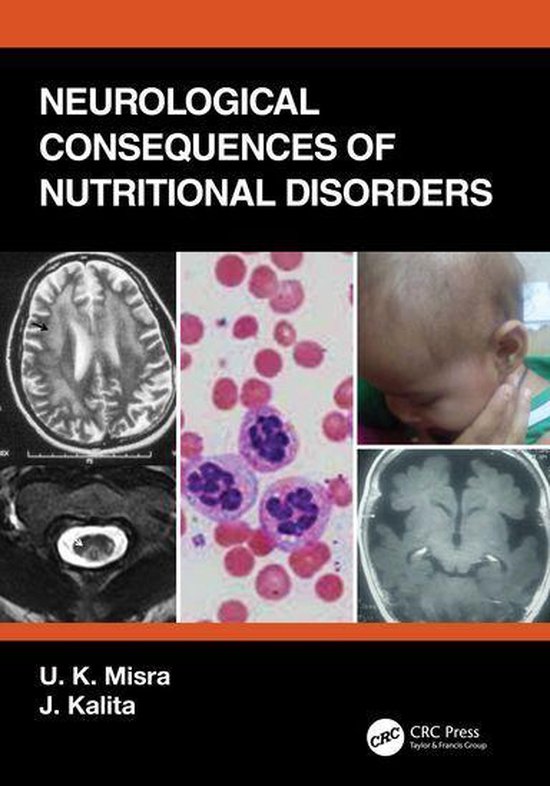 Neurological Consequences of Nutritional Disorders - cover