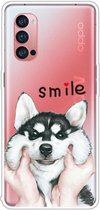 Voor OPPO Reno4 Pro Gekleurde tekening Clear TPU Cover Beschermhoesjes (Pinch Face Dog)