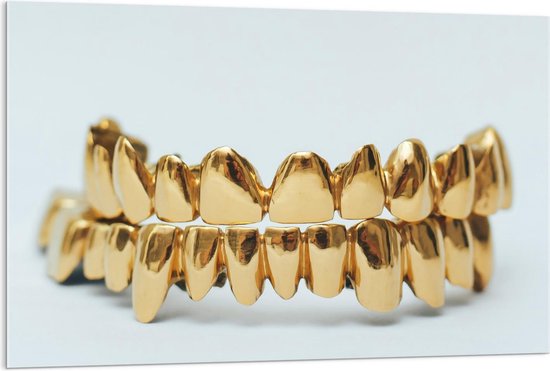 Acrylglas - Gouden Tanden op Witte Achtergrond - 120x80cm Foto op Acrylglas (Met Ophangsysteem)