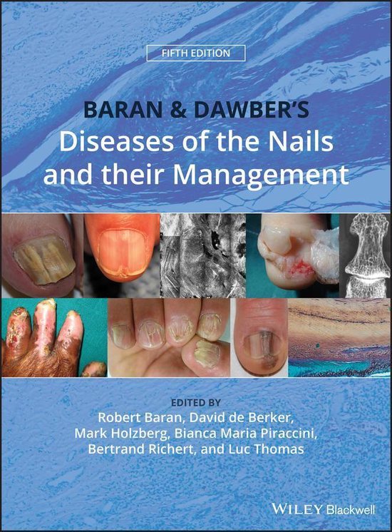 Baran and Dawber's Diseases of the Nails and their Managemen ... - cover