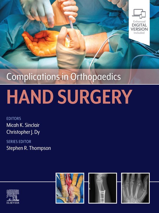 Complications in Orthopaedics - Complications in Orthopaedic ... - cover