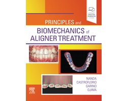 Principles and Biomechanics of Aligner Treatment - E-Book