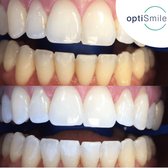 Professionele Tandenbleekset - Veilig Tanden Bleken - 80% minder Peroxide - Witte Tanden - Teeth Whitening - LED - Handleiding -
