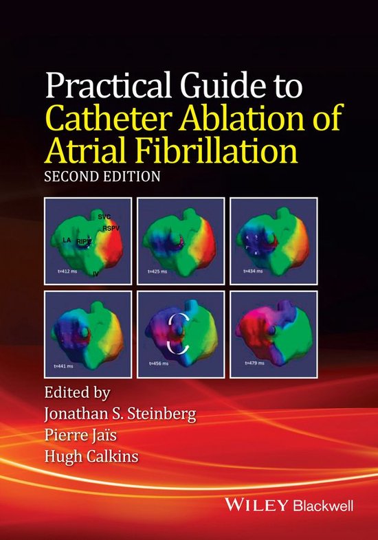 Foto: Practical guide to catheter ablation of atrial fibrillation