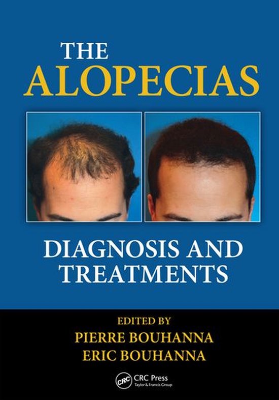 The Alopecias - cover