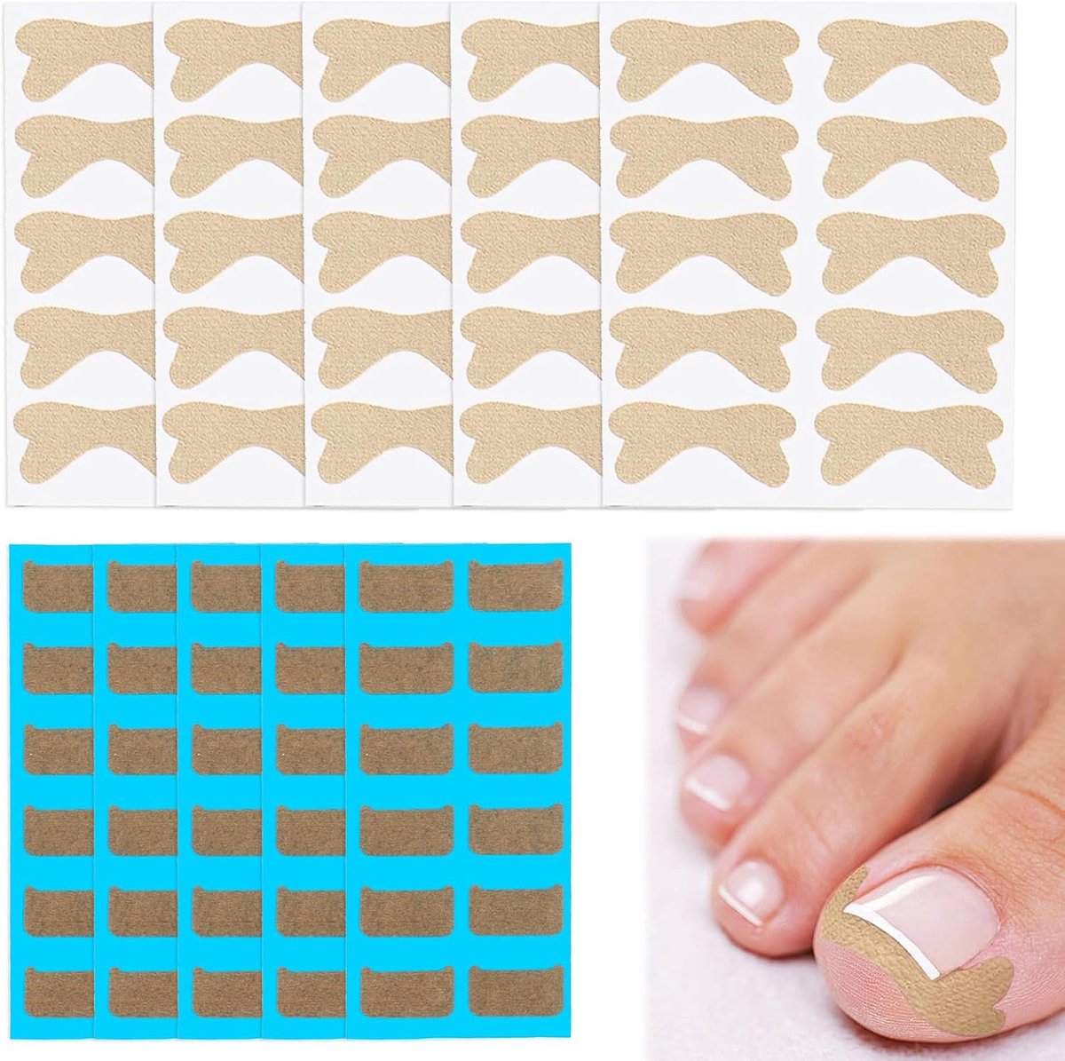 Correctiepatches voor ingegroeide nagels - 110 stuks - ademend en flexibel - pijnverlichting voor nagelgroei - ShopVlot