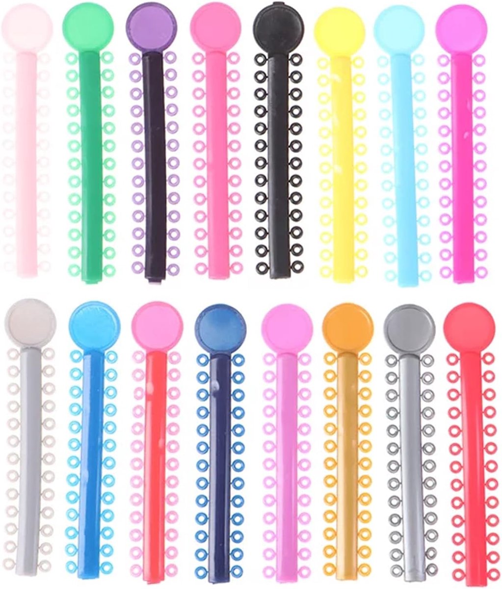 Orthodontische bindbanden 40 stuks - kleurrijk - veilige pasvorm - ideaal voor orthodontische behandeling - ShopVlot