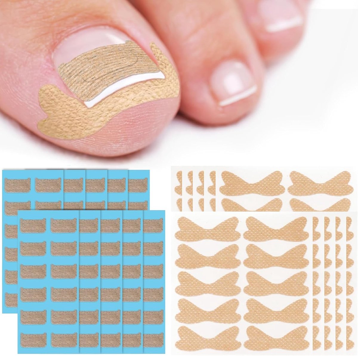 SnelShoppen - Pack van 20 Ademend Zelfklevende Patches voor Ingegroeide Teennagels, Comfortabele Nagelcorrectie Sticker voor Thuisgebruik