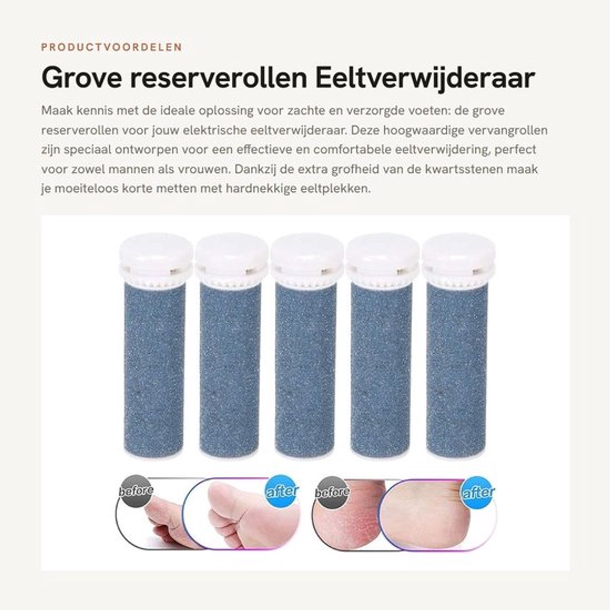 reserverollen - Eeltverwijderaar - Wasbaar en duurzaam - Extra grof - Pedicure-gereedschap - Geschikt voor uniseks voeten