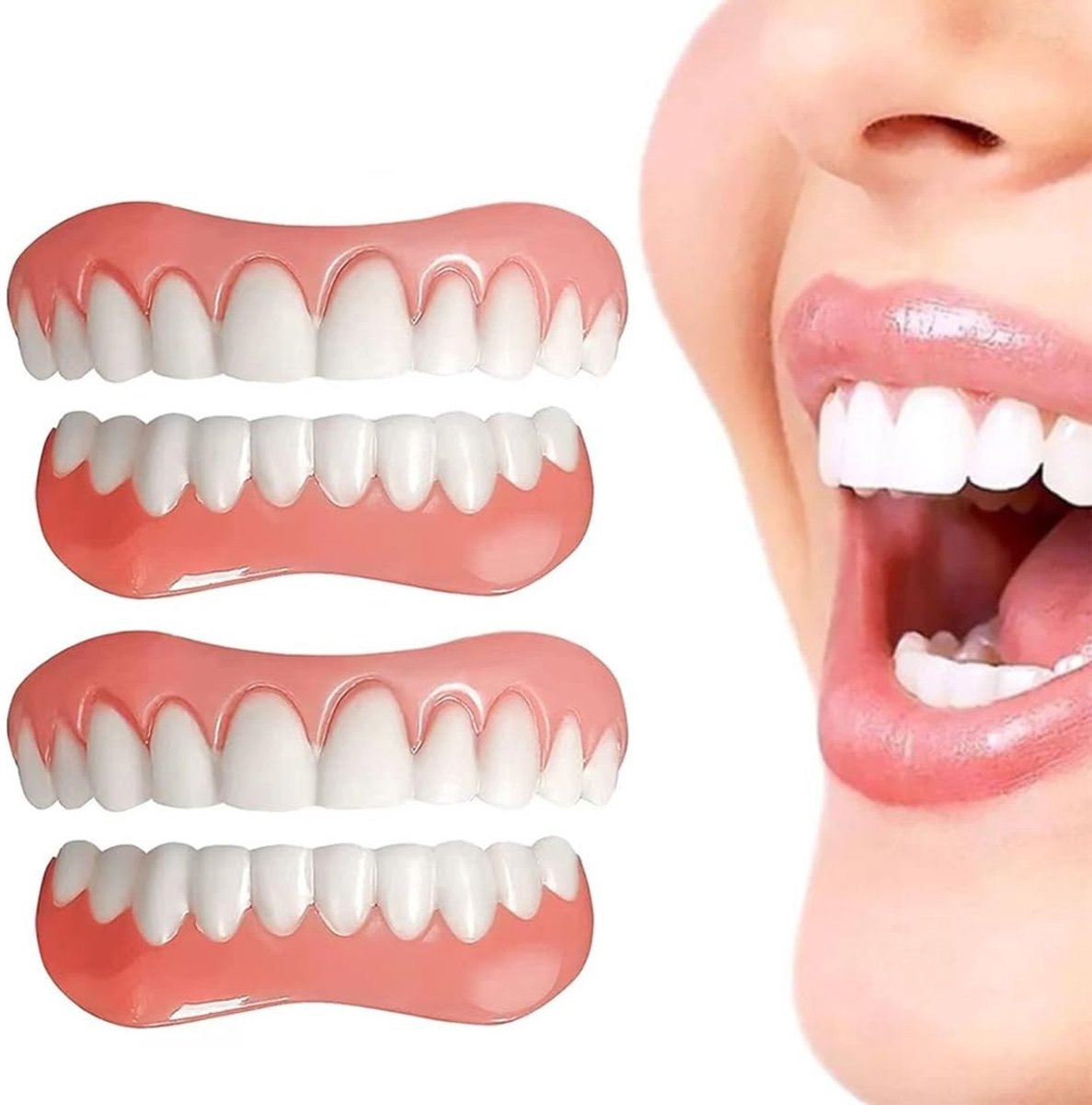 SolidKeus - Tandenwhitening Protheses voor Boven- en Onderkaak