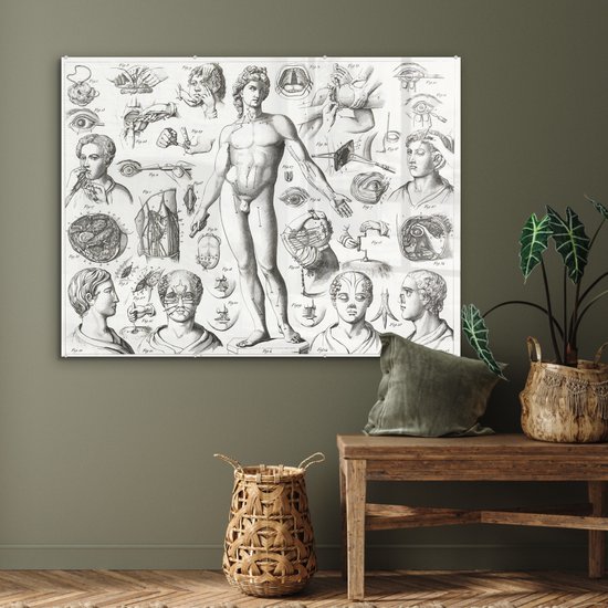 MuchoWow® Glasschilderij 120x90 cm - Schilderij acrylglas - Illustraties van verschillende chirurgische ingrepen - Foto op glas - Schilderijen