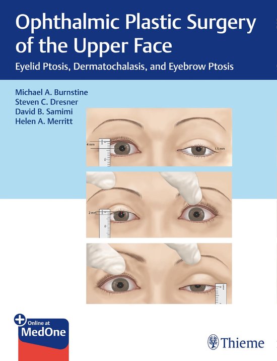 Ophthalmic Plastic Surgery of the Upper Face - cover