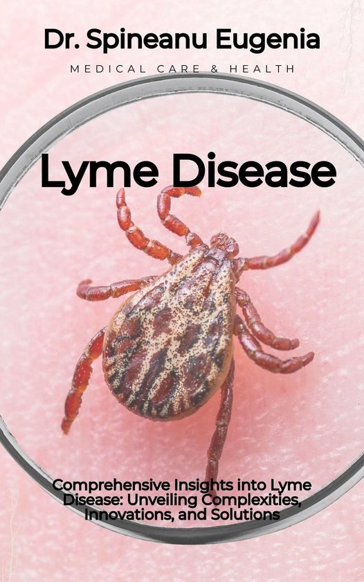 Comprehensive Insights into Lyme Disease: Unveiling Complexities ...