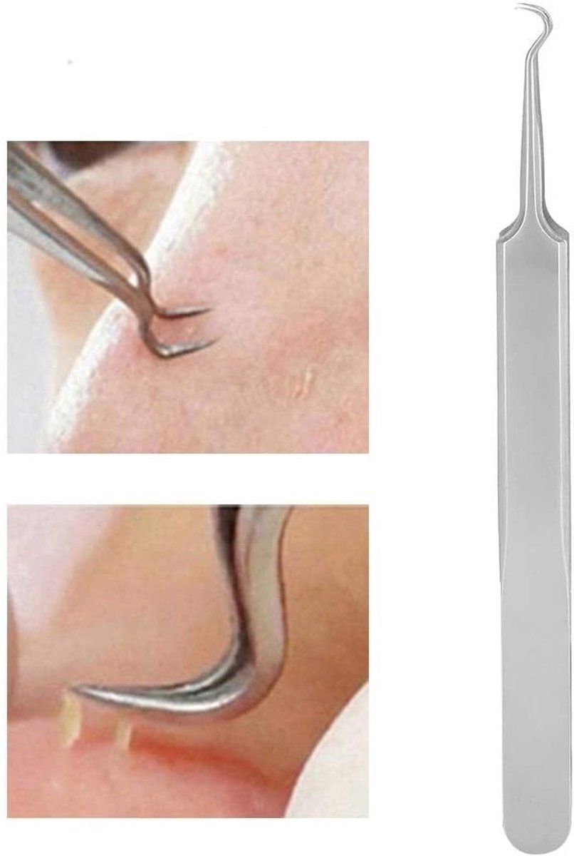 Precisie Zwarte Hoofdpunt Pincet van Roestvrij Staal, Gebogen Haak voor Comedonen, Ideaal voor Acne en Puistjes Verwijderen, Effectieve Huidverzorging Tools