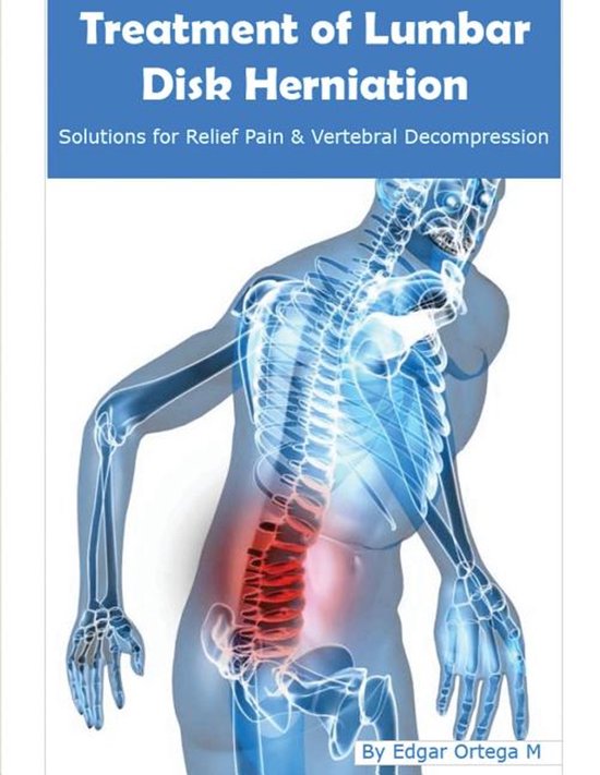 Treatment of Lumbar Disk Herniation - cover