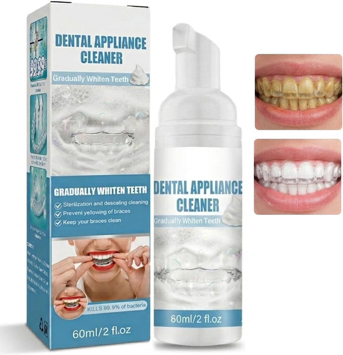 60 ml reiniging voor tandapparaten - ShopVlot