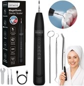 Zenwire J09 Ultrasone Tandsteenverwijderaar - 3 Standen - LED - USB-C