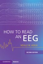 How to Read an EEG