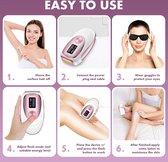IPL Lichtontharing ,  Hair Removal