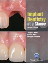 At a Glance (Dentistry) - Implant Dentistry at a Glance