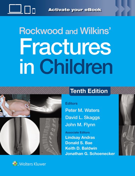Rockwood and Wilkins' Fractures in Children: Print + eBook w ... - cover