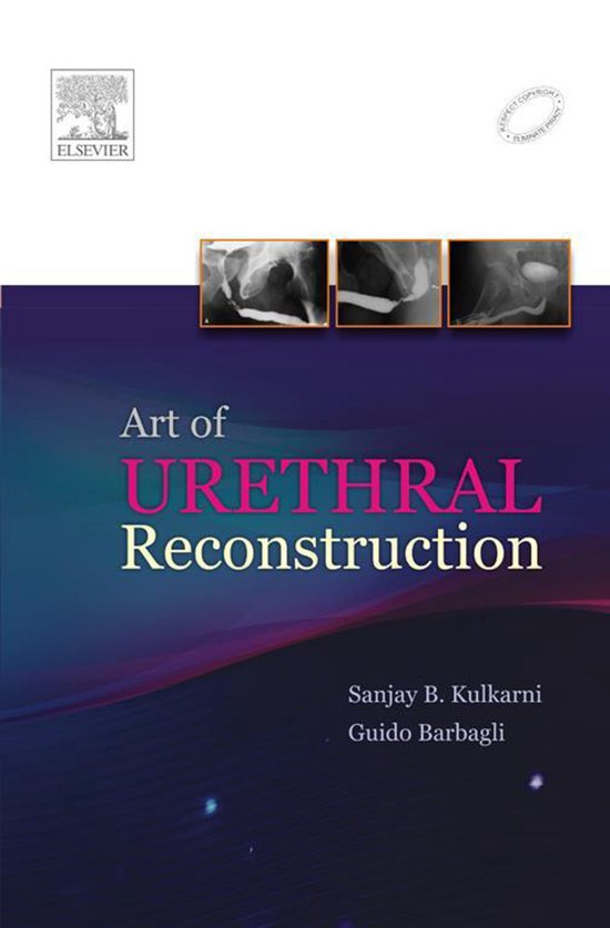 Art of Urethral Reconstruction - E-Book - cover