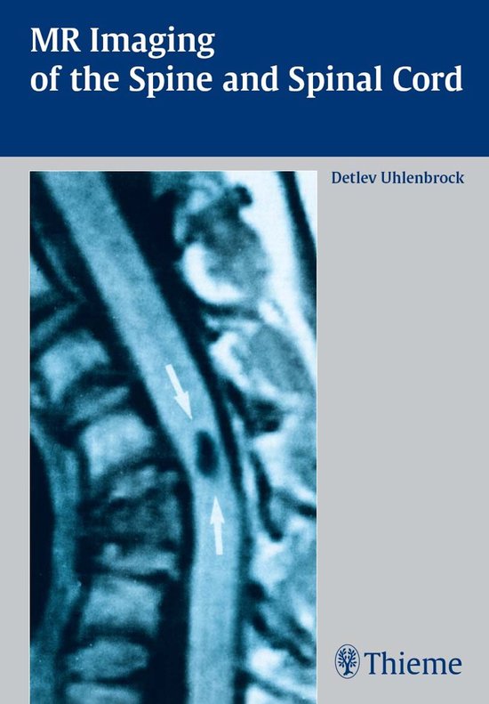 MR Imaging of the Spine and Spinal Cord - cover