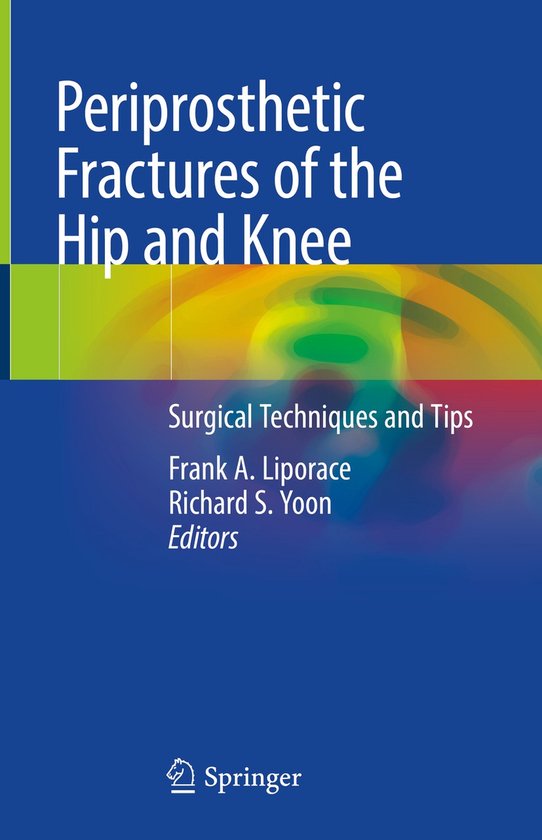 Periprosthetic Fractures of the Hip and Knee - cover