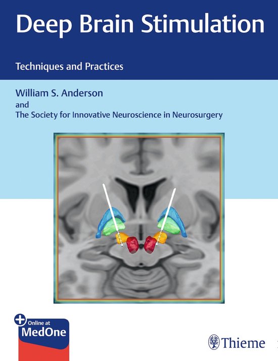Deep Brain Stimulation - cover