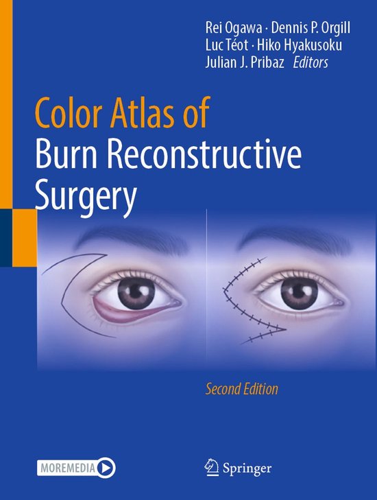 Medicine (R0) - Color Atlas of Burn Reconstructive Surgery - cover