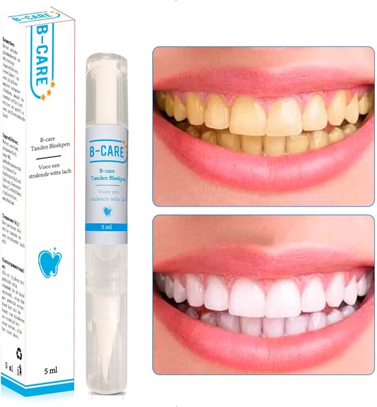 B-care Tanden Bleekpen - Teeth Whitening Pen - Tanden Bleker - Wittere Tanden - Teeth Whitening Strips - Professioneel Resultaat - Tandsteen Verwijderaar - Zonder Peroxide - Tandenbleekset - Tanden Bleken