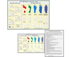 Het menselijk lichaam - anatomie poster voet en voetafwijkingen (Nederlands, gelamineerd, A2 + A4)