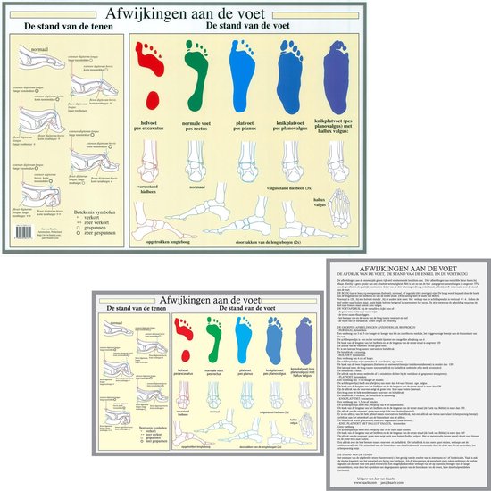 Het menselijk lichaam - anatomie poster voet en voetafwijkingen (Nederlands, gelamineerd, A2 + A4)