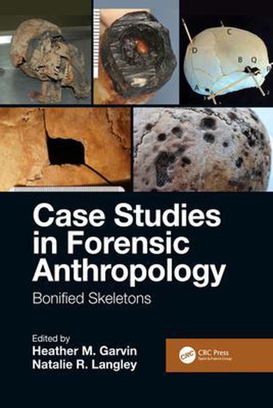 forensic anthropology case studies for students