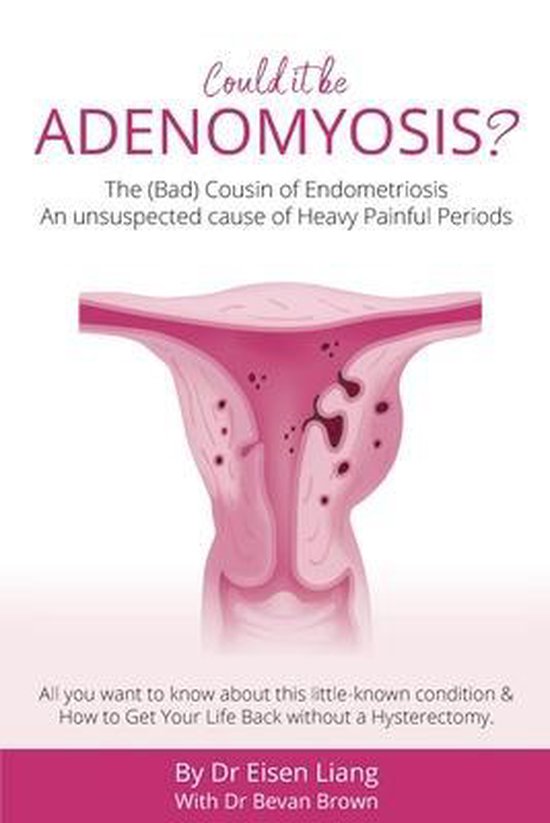 Adenomyosis -The Bad Cousin of Endometriosis - cover