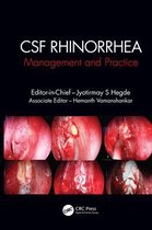 CSF Rhinorrhoea