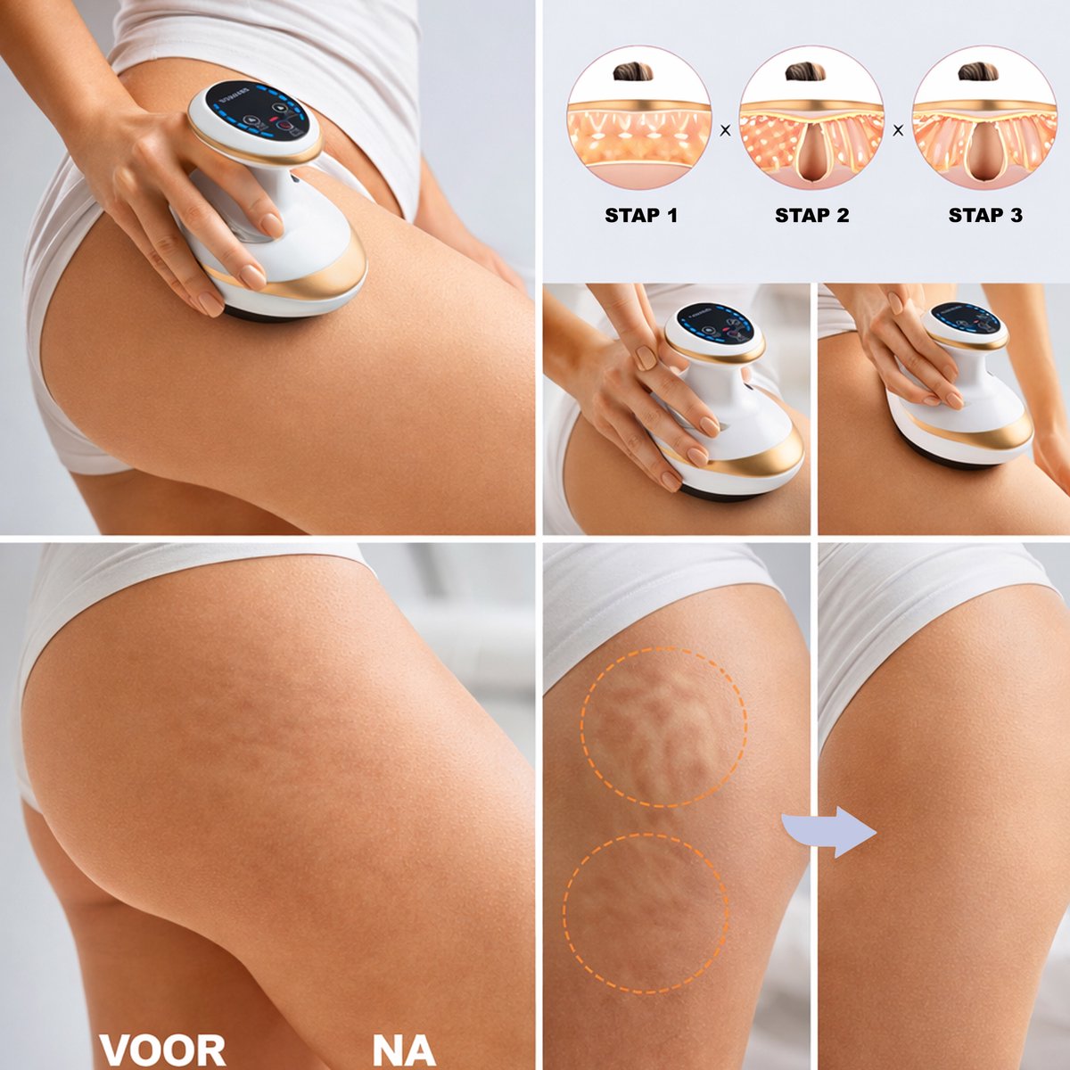 The Useful Cupping Massage Apparaat met Gua Sha Functie - afbeelding 2
