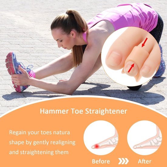 Hamerteen-corrector, 6-delige set met gel-teenbandjes - Hamerteen-steunkussentjes - Unisex-teenkussentjes - Gebogen teenklemmen - 2 maten: M/S - Onmisbaar. van Merkloos — afbeelding 2