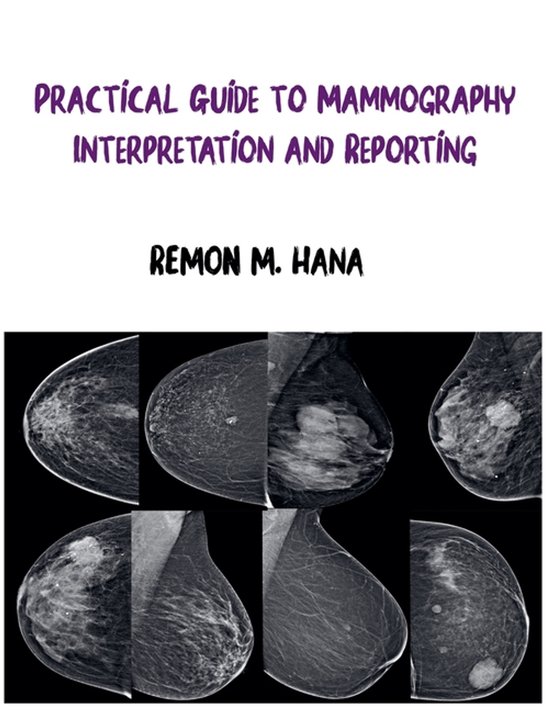Mammography Positioning Guidebook.pdf Practical Guide to Mammography Interpretation and Reporting ...