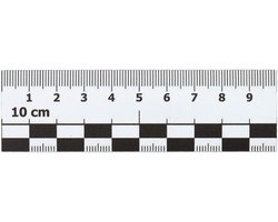 Smileyboard Foto Schaal Magneet – 10 cm Voertuigmagneet voor Schade Markering – Ideaal voor Experts en Taxateurs