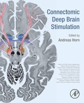 The Stimulated Brain (ebook), Roi Cohen Kadosh | 9780124047129
