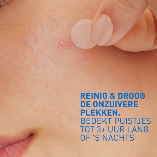 CeraVe Anti-Puistjes Patches - Voor een acne-gevoelige huid – Met 3 Essentiële Ceramiden & Niacinamide - 22 patches
