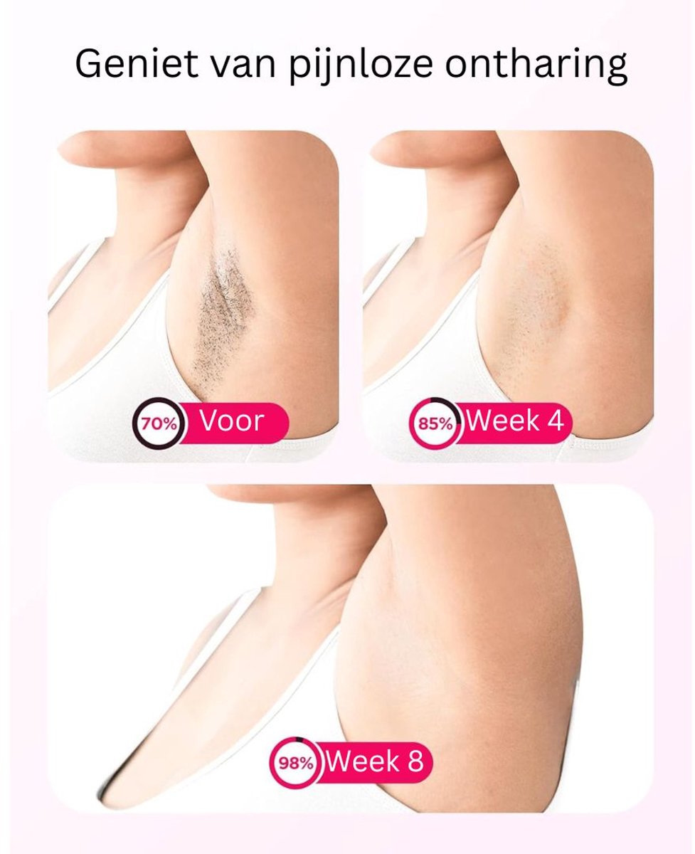 CLVP® Laser Ontharingsapparaat - IPL Ontharing - Mannen & Vrouwen - Zwart thumbnail 3